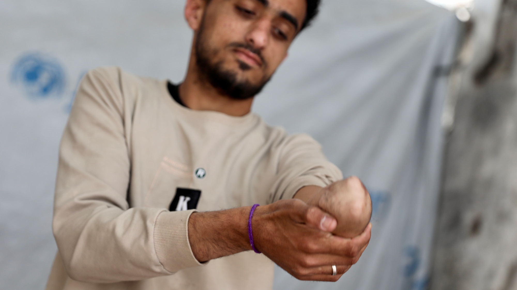 'I feel like I lost my life': Gaza amputees fight for mobility amid shortages