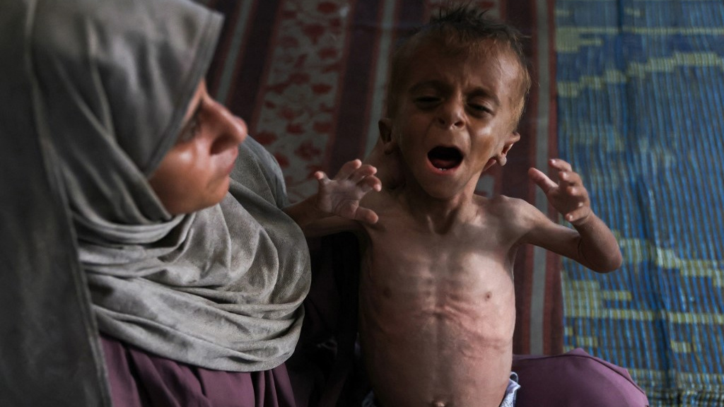 Gaza starvation: Why Israel's supporters are misrepresenting Unicef study