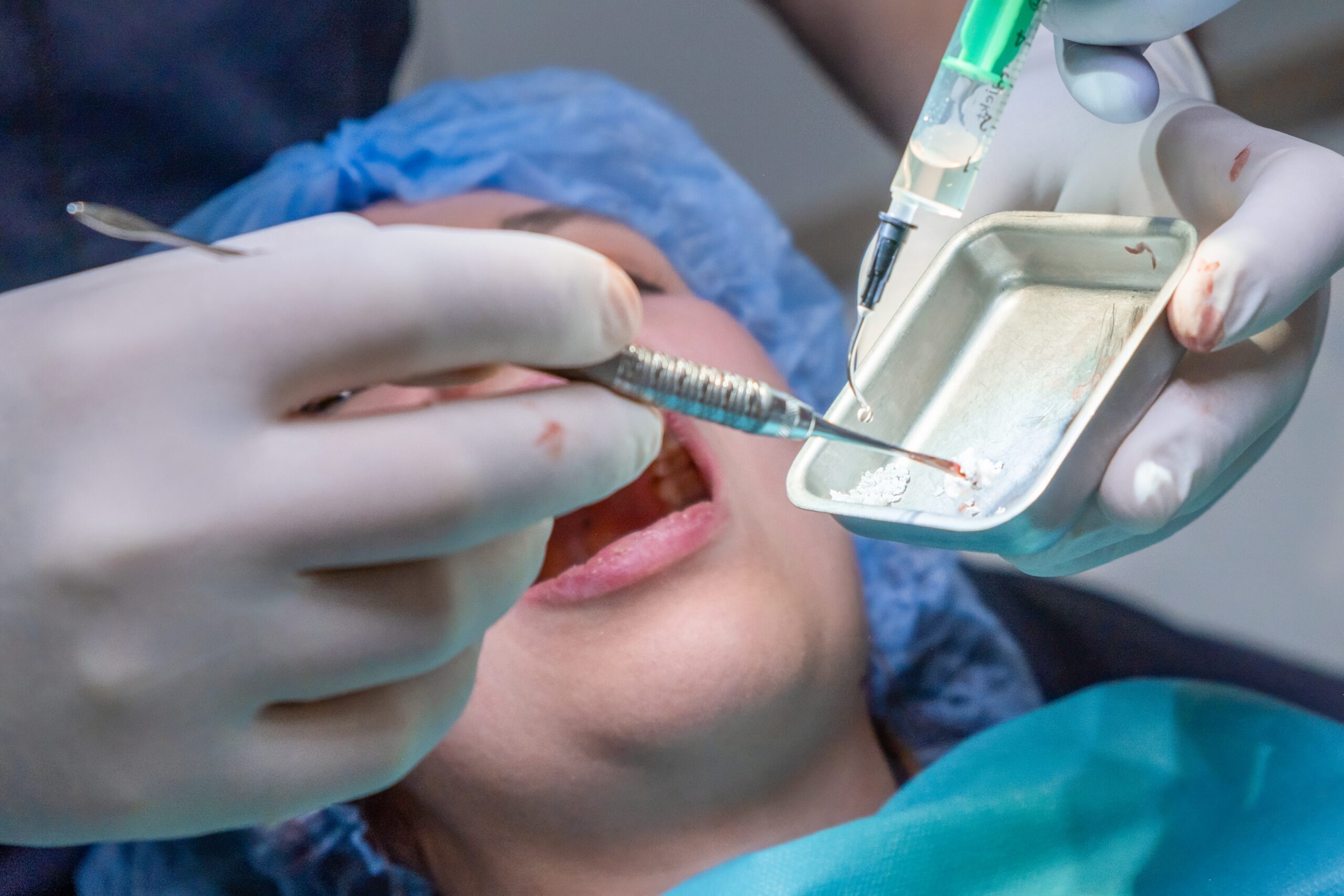 Muslim patients risk receiving pig or other animal bone in dental implants without knowing, report warns